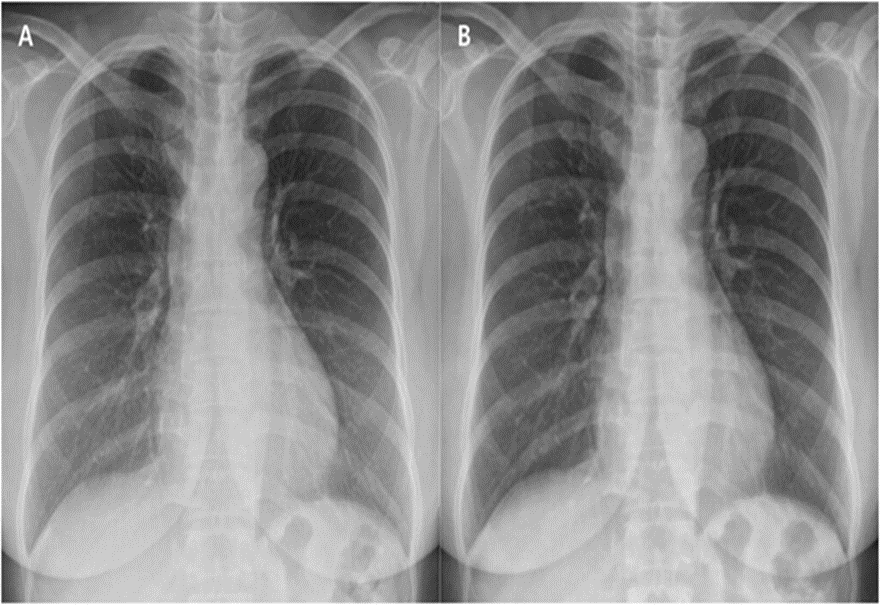 radiology mcqs with explanation